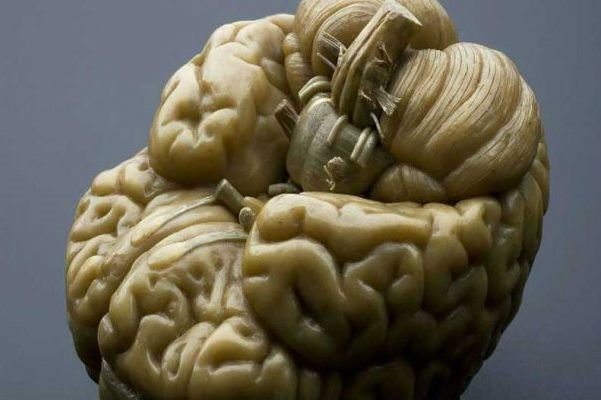 اندازه گیری هوش انسان از روی تصاویر مغزی